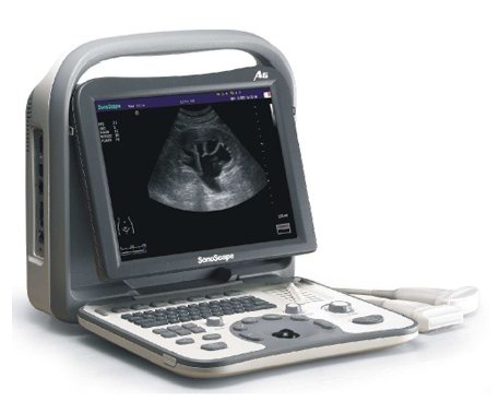 Sonoscape A6V Ultrasound