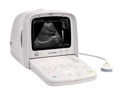 CTS-3300 Ultrasound