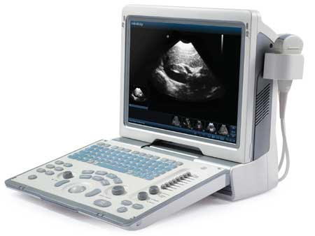 Sonoscape A6V Ultrasound